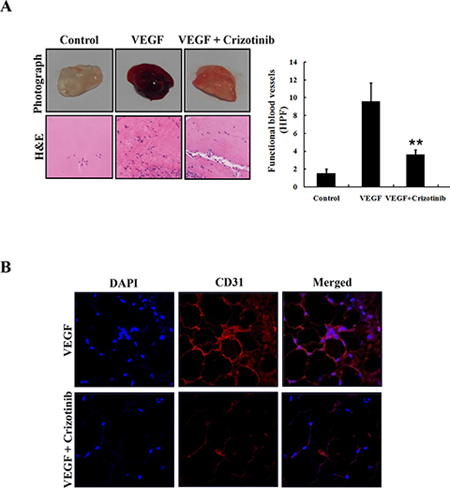 Inhibition of angiogenesis by Crizotinib.