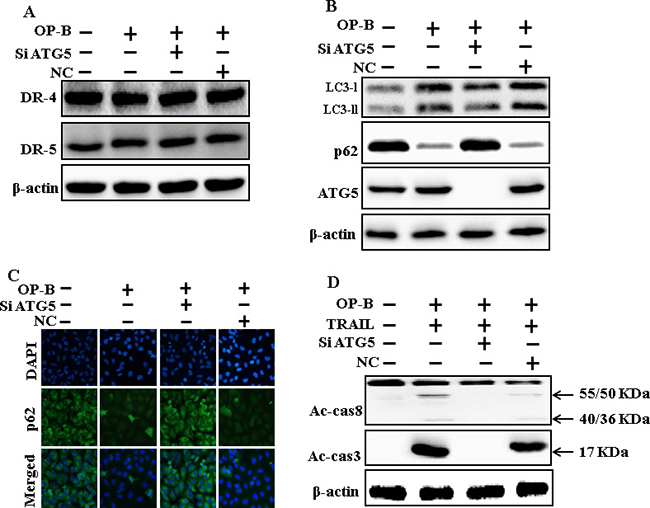 Genetic attenuation of autophagy encloses TRAIL-initiated apoptosis by Ophiopogonin B via autophagy flux incitation.