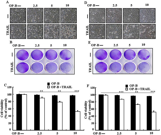 Ophiopogonin B sensitizes TRAIL-initiated apoptosis in HCC-15 and Calu-3 cells.