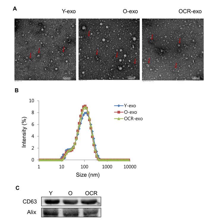 Characterization of exosomes purified from serum of young, old, and old-CR rats.