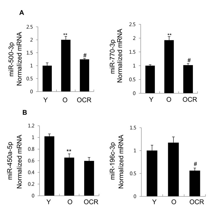 Expression of 4 miRNAs in exosomes purified from young, old, and old-CR rats.