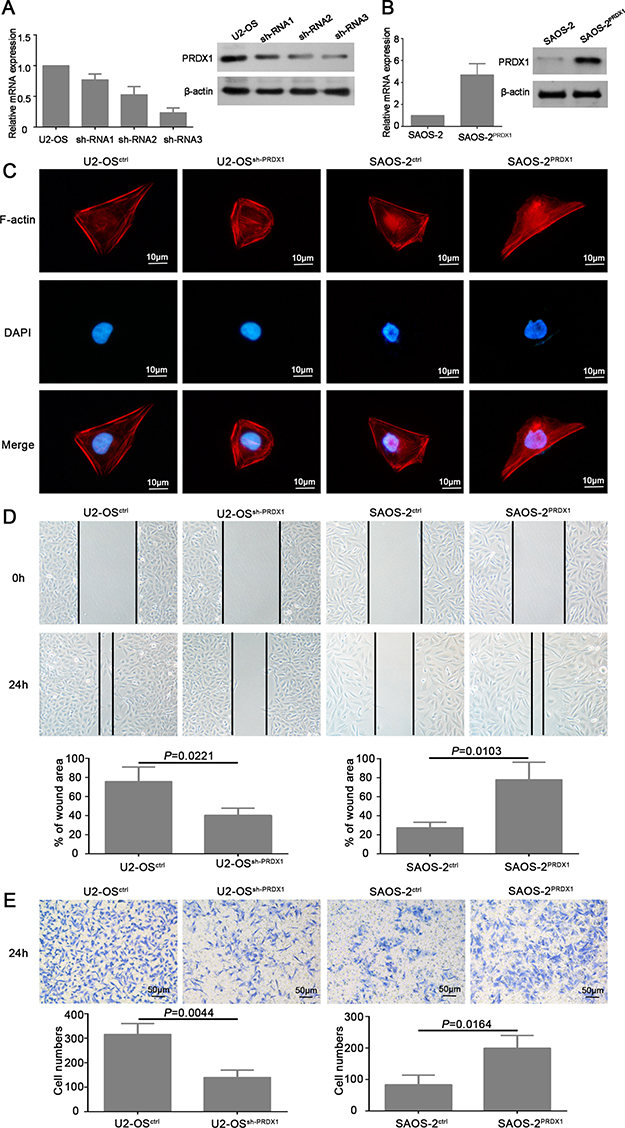 PRDX1 promotes migration and invasion of osteosarcoma cells in vitro.