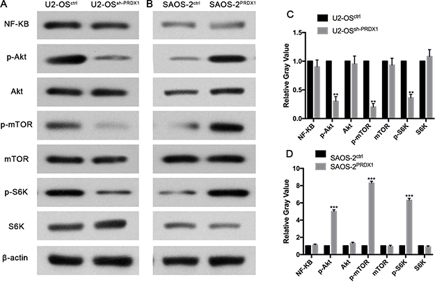 PRDX1 enhances metastasis of osteosarcoma through Akt/mTOR/S6K pathway.