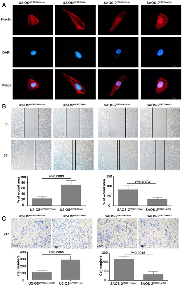 Akt is a critical downstream effector in PRDX1-promoted proliferation in osteosarcoma.