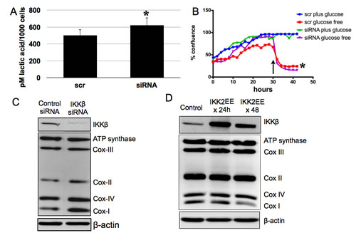 IKK&#x3b2; does not fully control glycolytic phenotype of EOC stem cells but is inversely correlated with Cox-I.