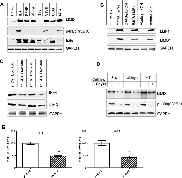 LIMD1 is upregulated by NF&#x03BA;B and IRF4 in virus-transformed cells.