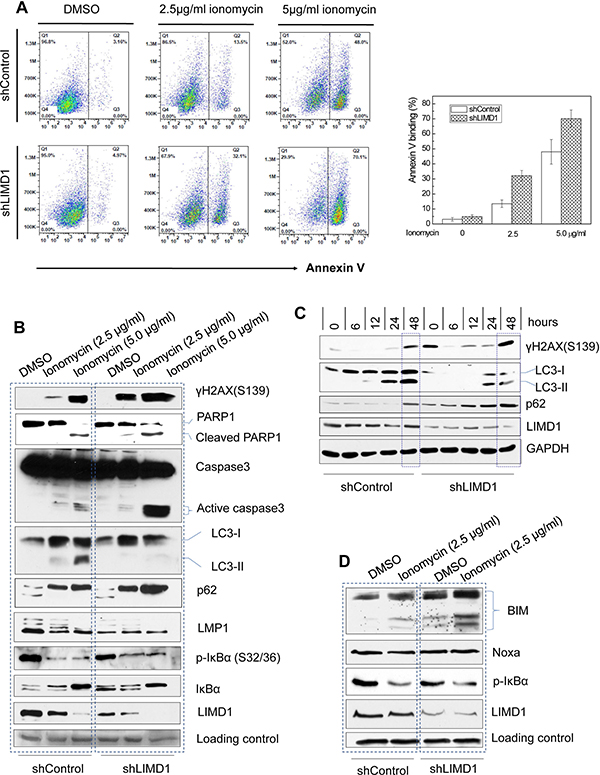 LIMD1 depletion potentiates ionomycin-induced DNA damage and apoptosis, and impairs autophagy.