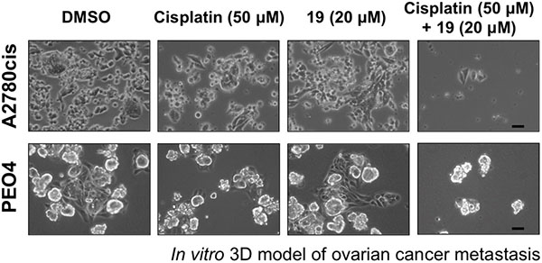 Exposure of ovarian cancer spheroids to the combination of compound 19 and cisplatin prevents spheroids reattachment and spreading.