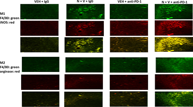 Prior [neratinib + valproate] exposure enhances the invasion of active NK cells, activated T cells and M1 polarized macrophages into 4T1 tumors.