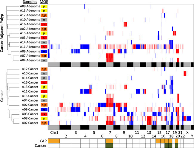 Heatmap of the CNA analysis and hierarchical clustering of the cases by adenoma and carcinoma.