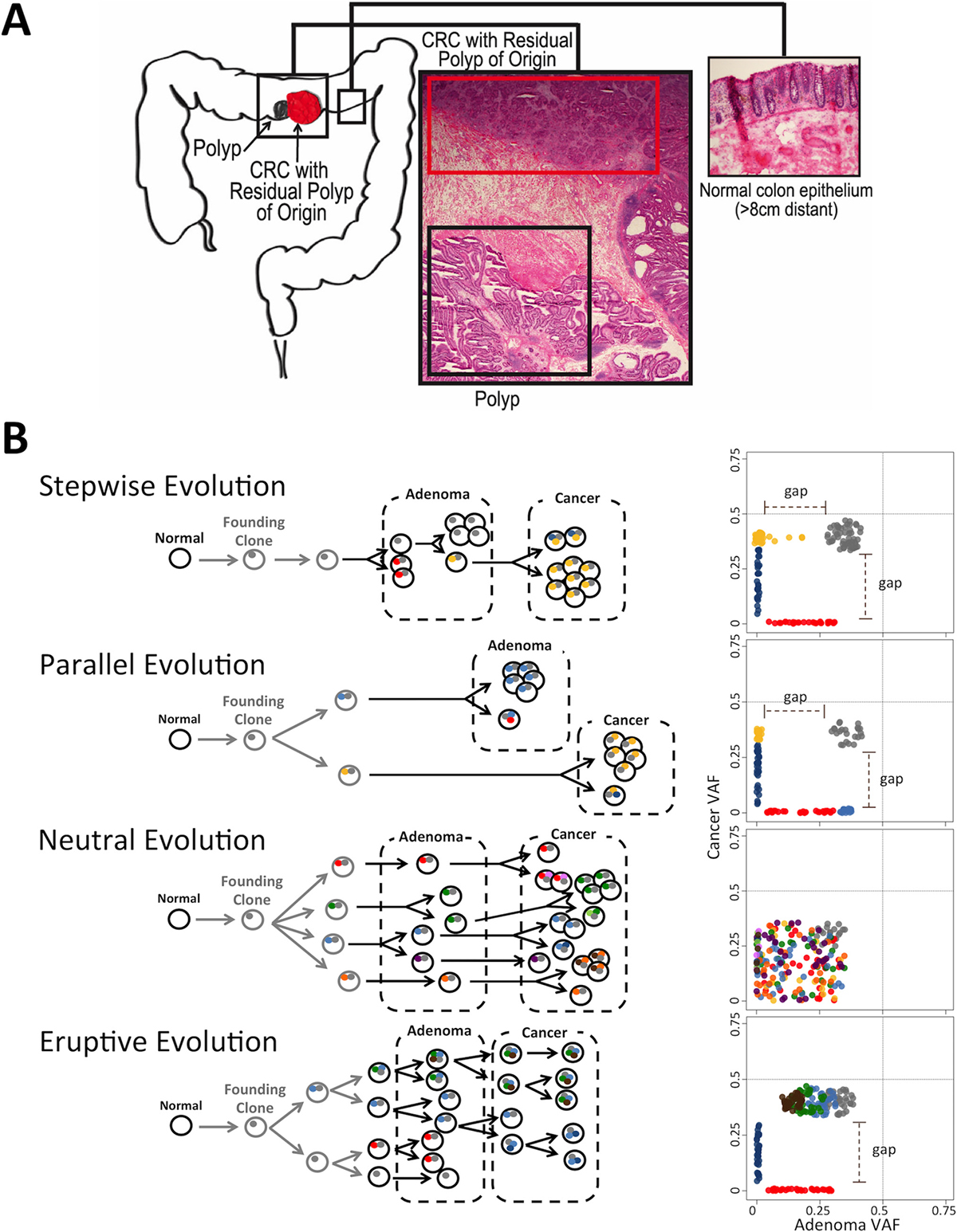 Modes of Evolution (MOE) in the transformation from adenoma to cancer and resulting AF distributions.