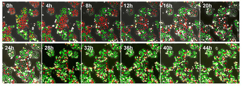 Time-lapse imaging of FUCCI-expressing HeLa cells treated with rMETase.