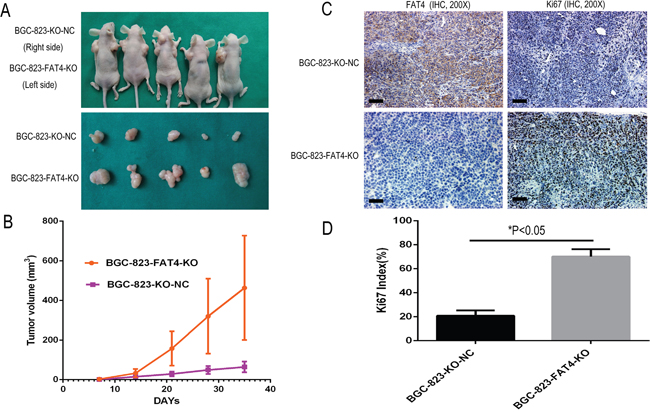 Effect of FAT4 knockout on GC tumorigenesis in the nude mice xenograft model.