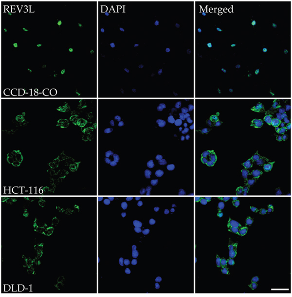 Immunostaining analysis of the location of REV3L in normal colon and colon cancer cell lines.