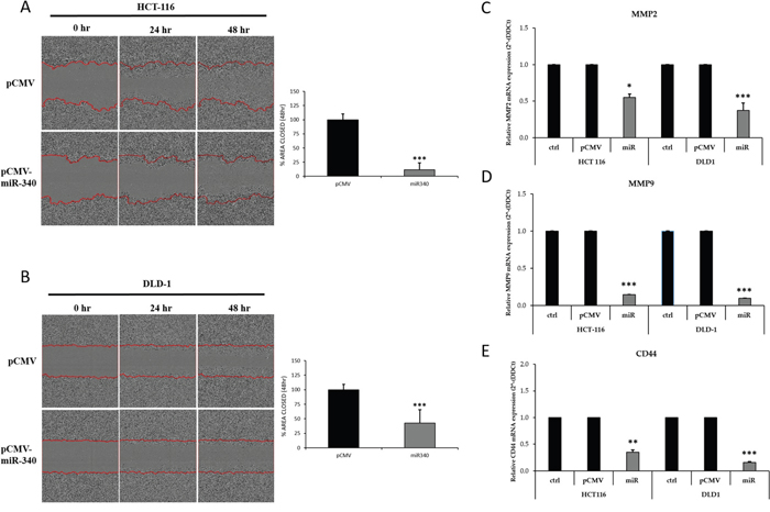 Transfection of colon cancer cells with miR-340 suppresses migration and metastatic properties of cells in vitro.