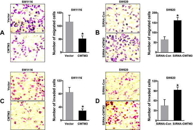 Effects of CMTM3 on cell migration and invasion in CRC cells.
