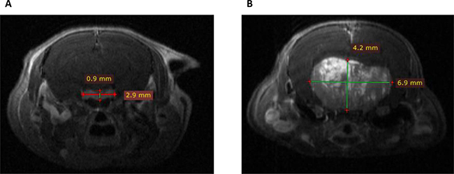 Coronal T1 weighted post-gadolinium enhanced Magnetic Resonance Imaging scans in Prlr+/+ and Prlr&#x2013;/&#x2013; 18-month-old female mice.