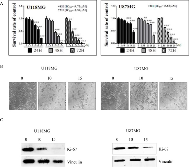 Cell cytotoxicity of NSC745887 upon treatment of U118MG and U87MG cells.