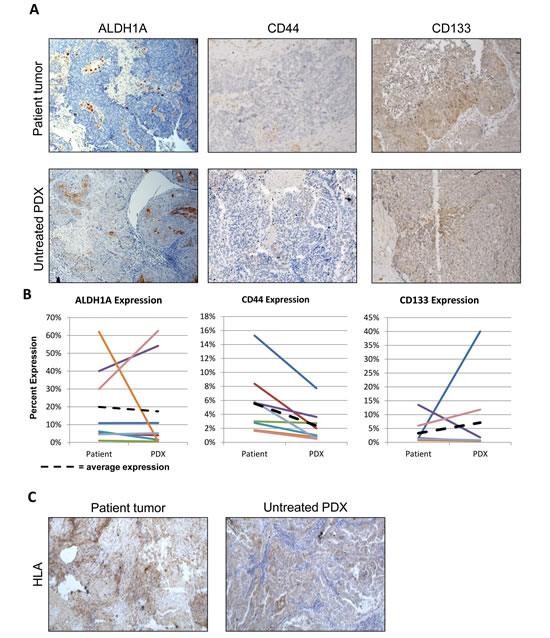 Establishment of the PDX line does not enrich for the tumorigenic cell population and human stroma is replaced in the implanted PDX.