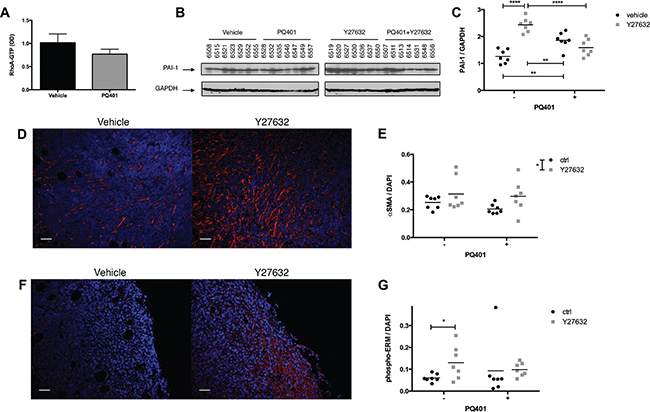 ROCK inhibition increases the recruitment of CAFs and PAI-1 expression in breast cancer xenografts.