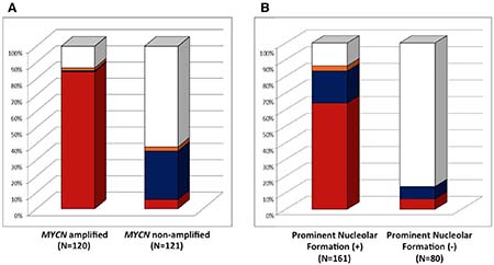 Neuroblastoma, undifferentiated and poorly differentiated subtype with a High Mitosis-Karyorrhexis Index. (A