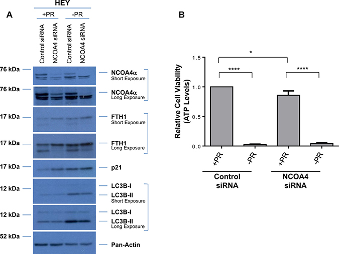 Cellular responses to NCOA4 knockdown is altered in response to factors present in FBS.
