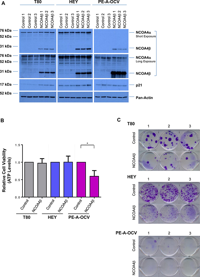 NCOA4&#x03B2; overexpression in T80, HEY, and PE-A-OCV cells reduces colony forming ability.