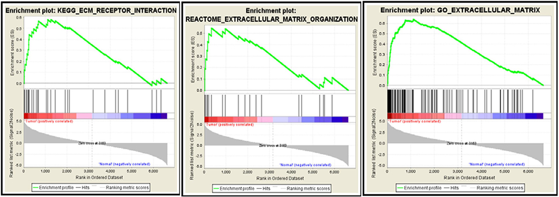 GSEA databases enrich the differentially expressed genes to ECM-associated pathways.