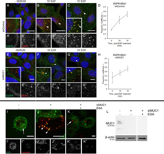 MUC1 does not delay EGFR association with EEA1, but does alter EGFR trafficking to the lysosome.