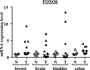 FOXO6 mRNA expressions in various cancers and normal tissues.