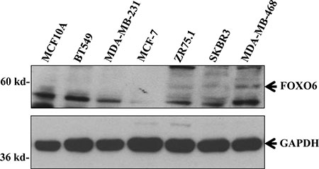 FOXO6 protein expression in various breast cell lines.