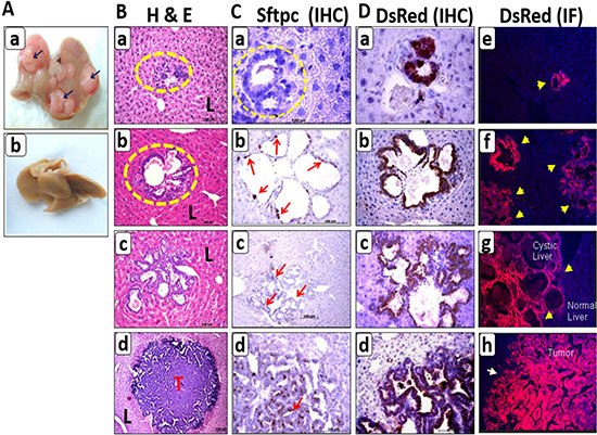 Lineage tracing in the metastatic model of Myc-BxB-DsRed transgenic mice depicts various steps of metastatic progression.