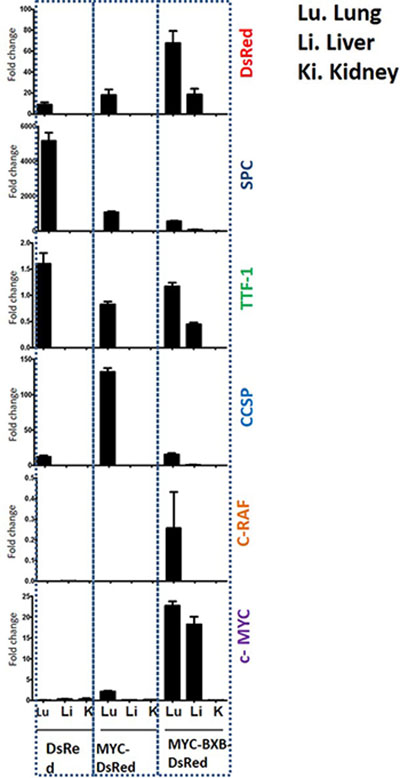 Validation of metastasis at the gene expression levels shows the expression of lineage-specific markers in the lung and liver of the metastatic mice MYC-BxB-DsRed mice.