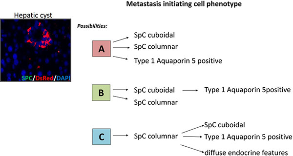 The proposed identity of the putative cell types responsible for metastasis in the current NSCLC model.