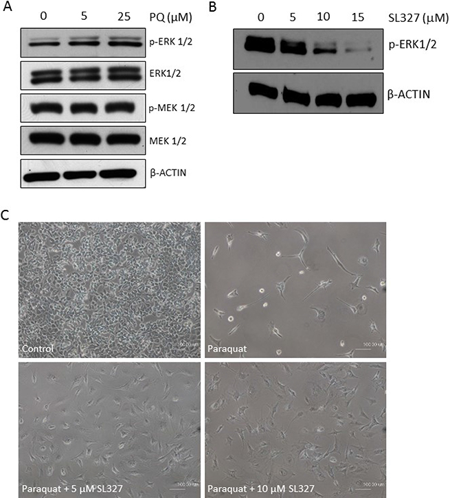 MAPK-ERK1/2 signaling is activated by high ROS in NT2 cells.