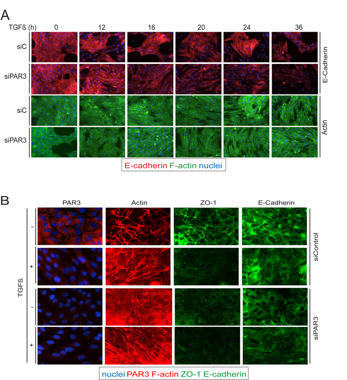 Par3 downregulation precipitates loss of cell-cell junctions in response to TGF&#x3b2;.