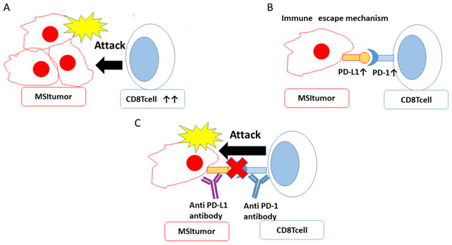 MSI allows tumor cells to escape the immune response and can be targeted by immune checkpoint inhibitors.