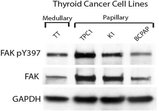Expression of pY397 FAK and FAK in thyroid cancer cell lines.