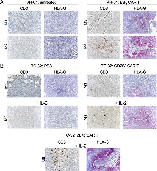 HLA-G expression in EwS xenografts following adoptive CAR T cell therapy.