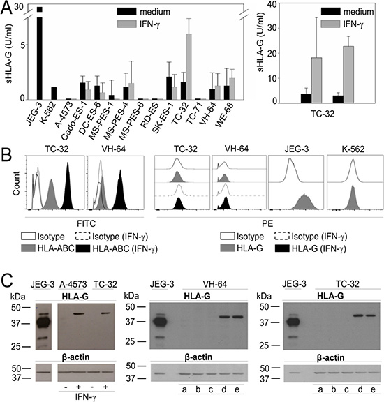 HLA-G is expressed in EwS cell lines in response to stimulation with IFN-&#x03B3; and in the presence of CAR T cells.