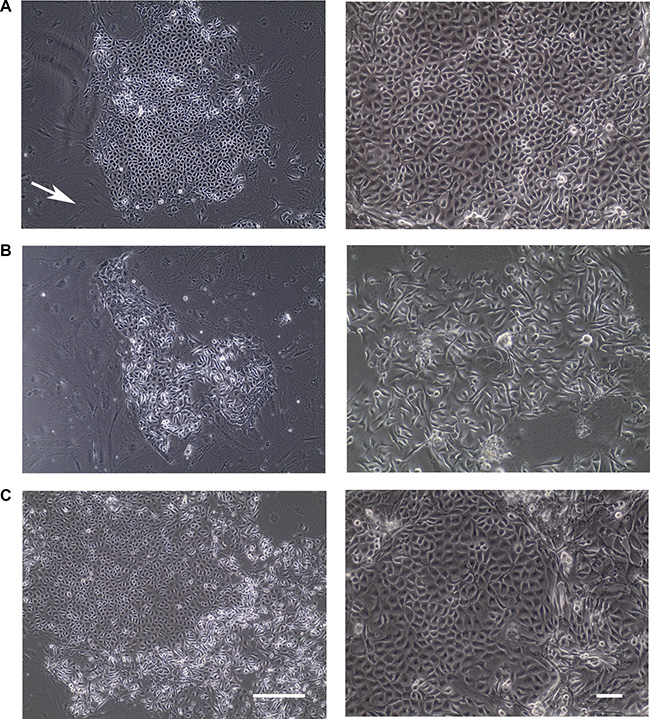 Colonies formed from normal human epithelial cells under conditional reprogramming condition.