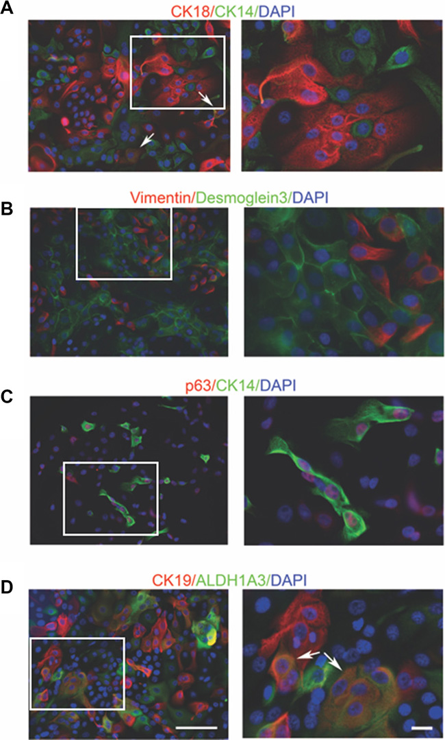 Immunofluorescent staining of mammary cell markers in conditional reprogrammed cells in early passage.