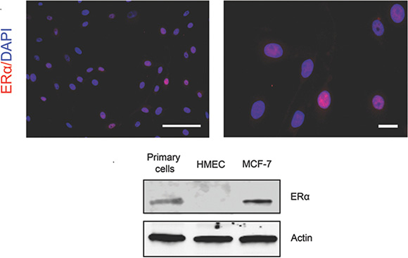 Expression of ER&#x03B1; in the cultured primary mammary epithelial cells.