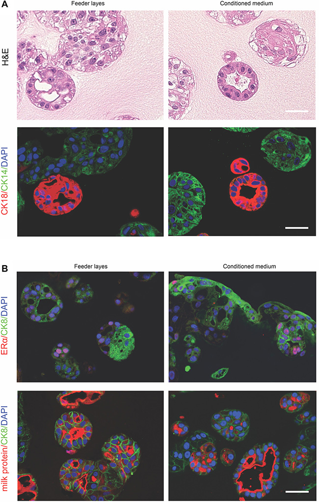 Conditional reprogrammed epithelial cells in 3D culture.