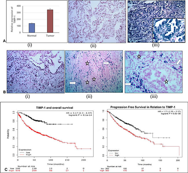 Comparison of relative expression of TIMP-1 and miR-125a-5p in normal adjacent lung tissue and lung adenocarcinoma.