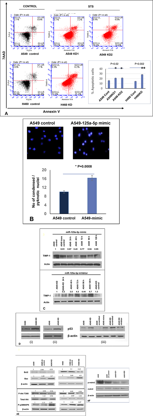 Increased level of miR-125a-5p in TIMP-1 KD clones is associated with induction of apoptosis and directly targets TIMP-1.