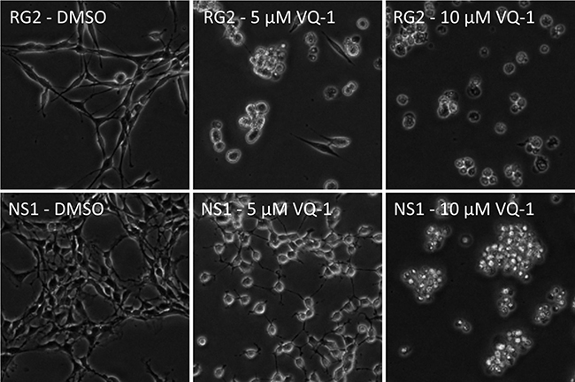 Microscopic images showing RG2 (top row) and NS1 cells (bottom row) exposed to increasing concentrations of VQ-1, 5 &#x03BC;M (center column) and 10 &#x03BC;M (right column) respectively.