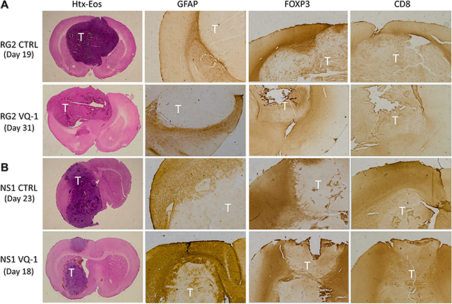 Immunohistochemical staining of excised brains.