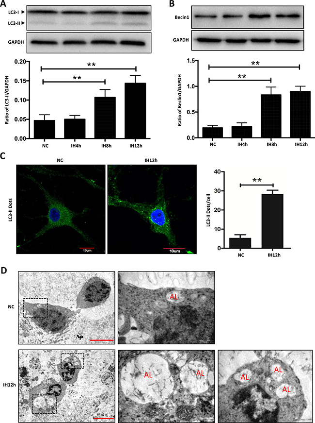Intermittent hypoxia increases the expression of markers for autophagy in hippocampal neurons.
