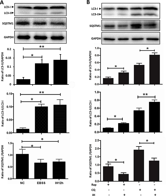 The effect of intermittent hypoxia on autophagy flux in hippocampal neurons.